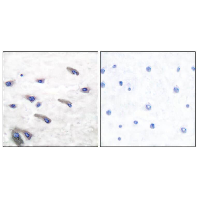 Immunohistochemistry - Anti-PDGF Receptor beta (phospho Tyr751) Antibody (A7194) - Antibodies.com
