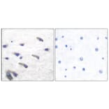 Immunohistochemistry - Anti-PDGF Receptor beta (phospho Tyr751) Antibody (A7194) - Antibodies.com