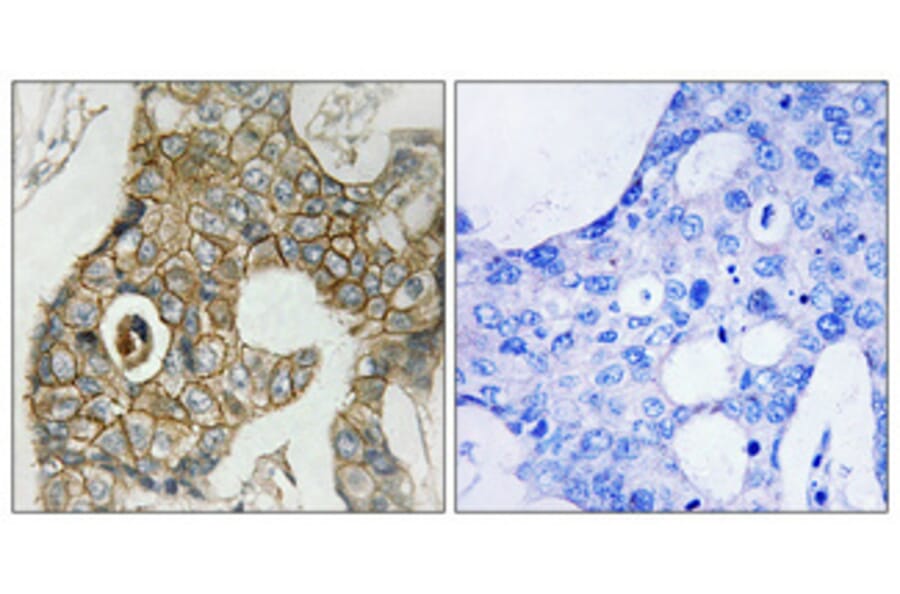 Immunohistochemistry - Anti-PDGF Receptor beta (phospho Tyr751) Antibody (A7194) - Antibodies.com