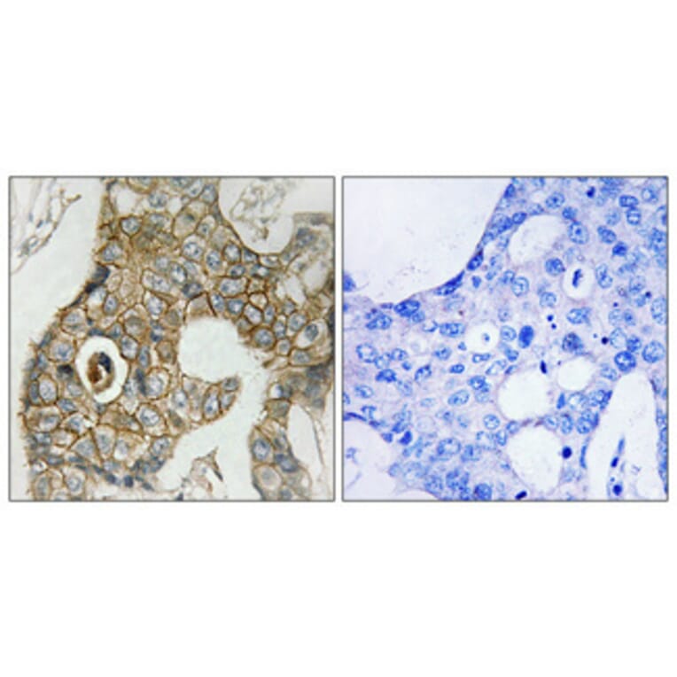 Immunohistochemistry - Anti-PDGF Receptor beta (phospho Tyr751) Antibody (A7194) - Antibodies.com