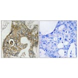 Immunohistochemistry - Anti-PDGF Receptor beta (phospho Tyr751) Antibody (A7194) - Antibodies.com