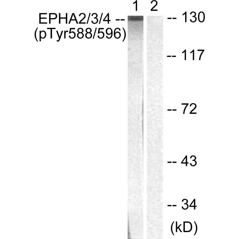Western Blot - Anti-EPHA2 + EPHA3 (phospho Tyr588 + Tyr596) Antibody (A0914) - Antibodies.com