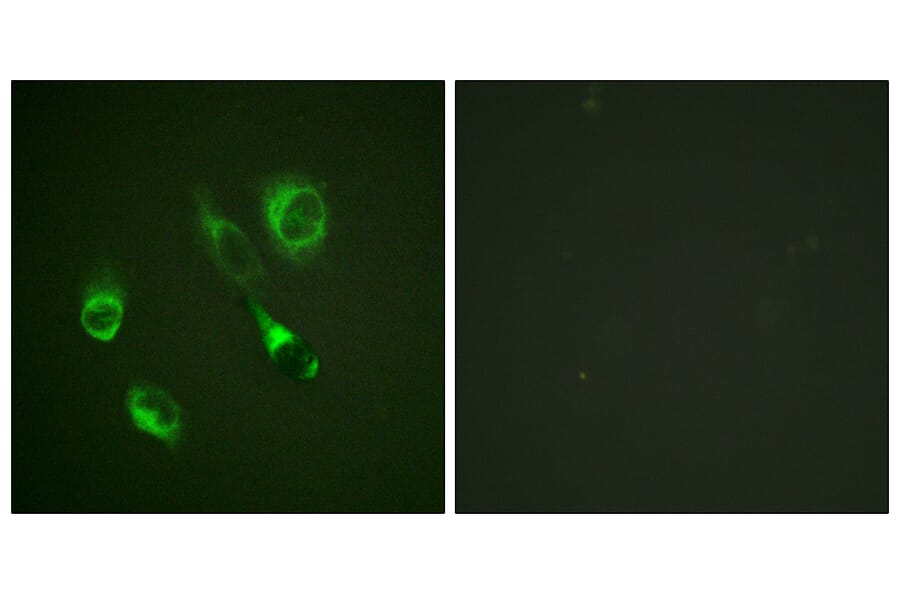Immunofluorescence - Anti-EPHA2 + EPHA3 (phospho Tyr588 + Tyr596) Antibody (A0914) - Antibodies.com