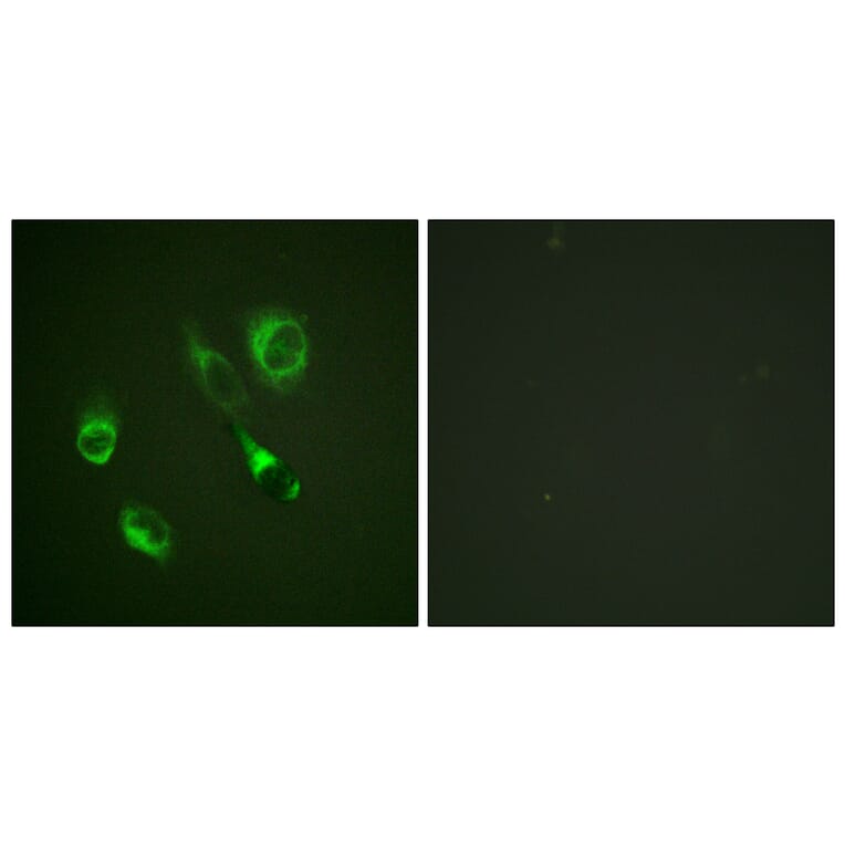 Immunofluorescence - Anti-EPHA2 + EPHA3 (phospho Tyr588 + Tyr596) Antibody (A0914) - Antibodies.com