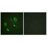Immunofluorescence - Anti-EPHA2 + EPHA3 (phospho Tyr588 + Tyr596) Antibody (A0914) - Antibodies.com