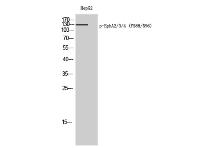 Western Blot - Anti-EPHA2 + EPHA3 (phospho Tyr588 + Tyr596) Antibody (A0914) - Antibodies.com