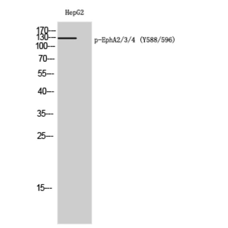 Western Blot - Anti-EPHA2 + EPHA3 (phospho Tyr588 + Tyr596) Antibody (A0914) - Antibodies.com
