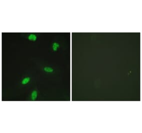 Immunofluorescence - Anti-Retinoblastoma (phospho Thr821) Antibody (A0811) - Antibodies.com