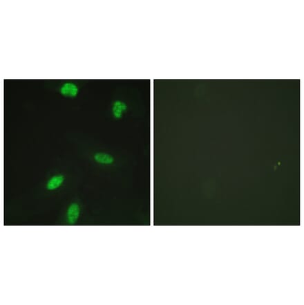 Immunofluorescence - Anti-Retinoblastoma (phospho Thr821) Antibody (A0811) - Antibodies.com