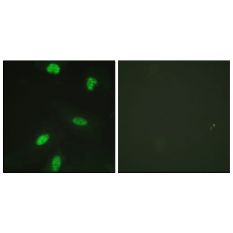 Immunofluorescence - Anti-Retinoblastoma (phospho Thr821) Antibody (A0811) - Antibodies.com