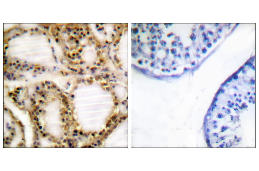 Immunohistochemistry - Anti-Retinoblastoma (phospho Thr821) Antibody (A0811) - Antibodies.com
