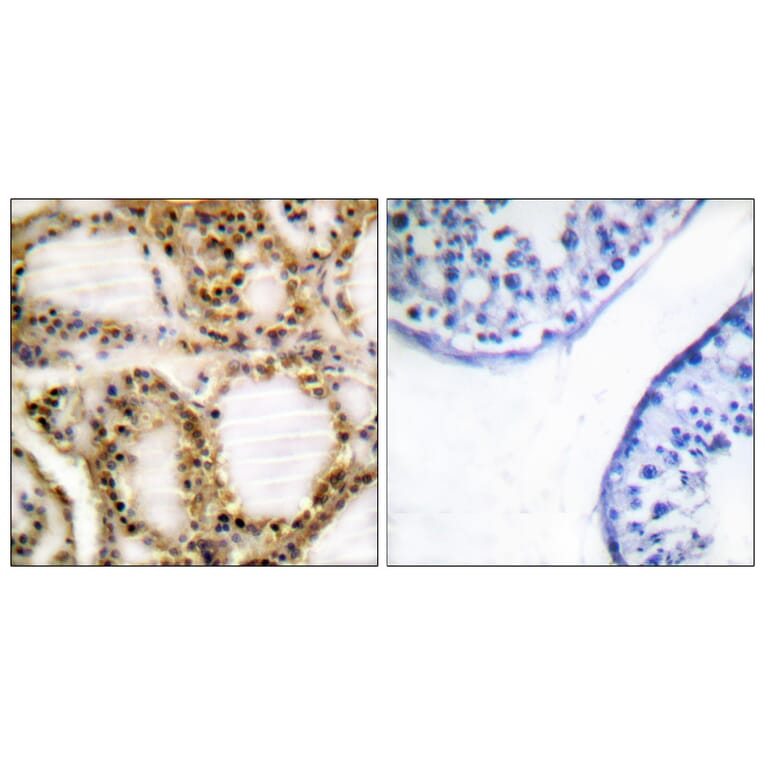 Immunohistochemistry - Anti-Retinoblastoma (phospho Thr821) Antibody (A0811) - Antibodies.com