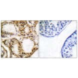 Immunohistochemistry - Anti-Retinoblastoma (phospho Thr821) Antibody (A0811) - Antibodies.com