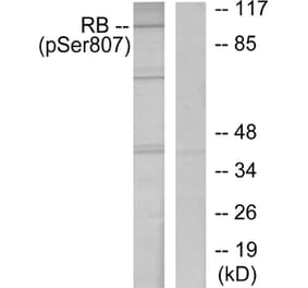 Western Blot - Anti-Retinoblastoma (phospho Ser807) Antibody (A7210) - Antibodies.com