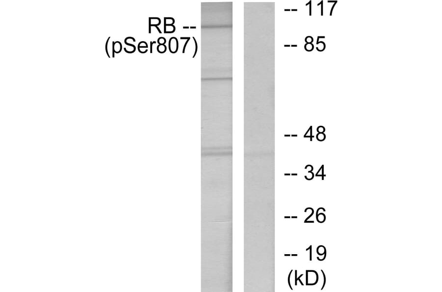 Western Blot - Anti-Retinoblastoma (phospho Ser807) Antibody (A7210) - Antibodies.com