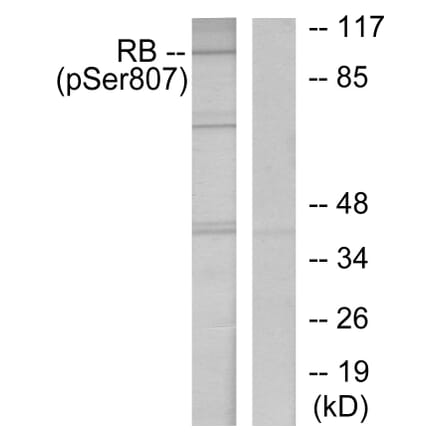 Western Blot - Anti-Retinoblastoma (phospho Ser807) Antibody (A7210) - Antibodies.com