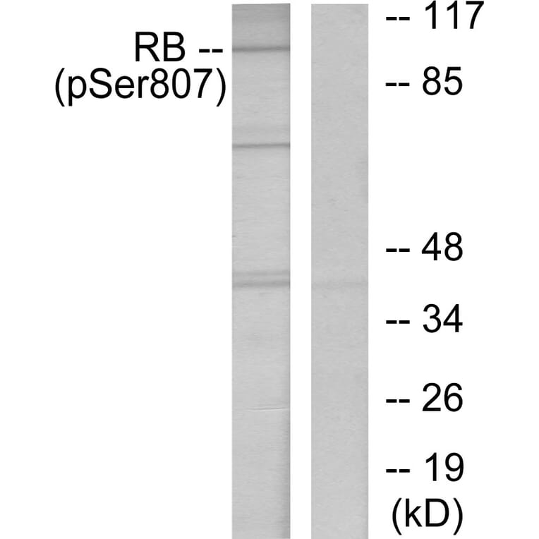 Western Blot - Anti-Retinoblastoma (phospho Ser807) Antibody (A7210) - Antibodies.com