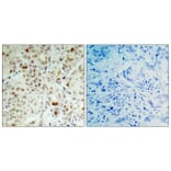 Immunohistochemistry - Anti-Retinoblastoma (phospho Ser807) Antibody (A7210) - Antibodies.com