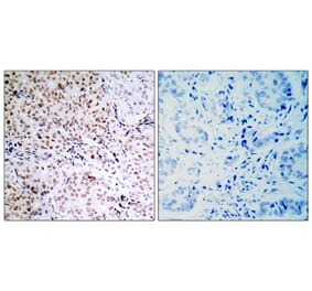 Immunohistochemistry - Anti-Retinoblastoma (phospho Ser795) Antibody (A7209) - Antibodies.com