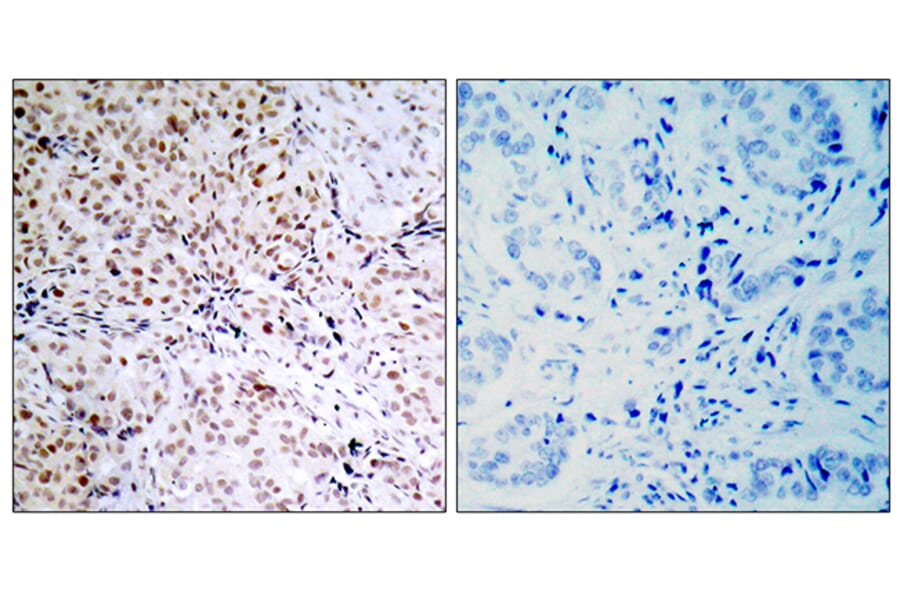 Immunohistochemistry - Anti-Retinoblastoma (phospho Ser795) Antibody (A7209) - Antibodies.com