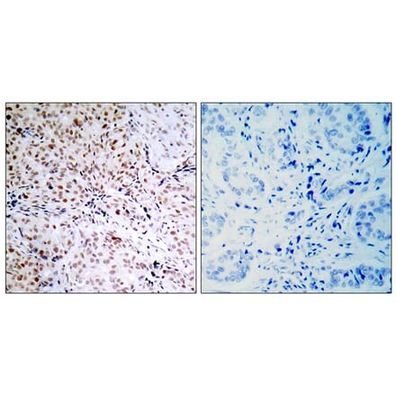 Immunohistochemistry - Anti-Retinoblastoma (phospho Ser795) Antibody (A7209) - Antibodies.com