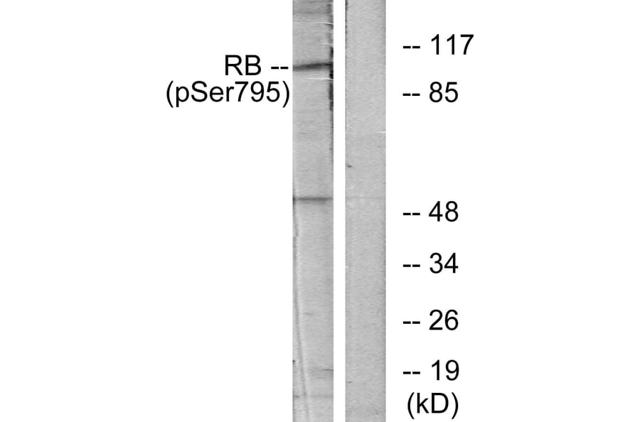 Western Blot - Anti-Retinoblastoma (phospho Ser795) Antibody (A7209) - Antibodies.com