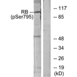 Western Blot - Anti-Retinoblastoma (phospho Ser795) Antibody (A7209) - Antibodies.com