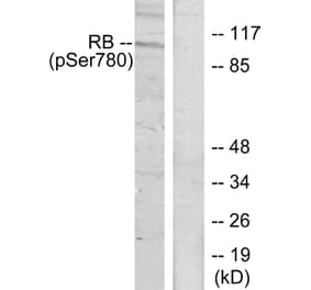 Western Blot - Anti-Retinoblastoma (phospho Ser780) Antibody (A7208) - Antibodies.com