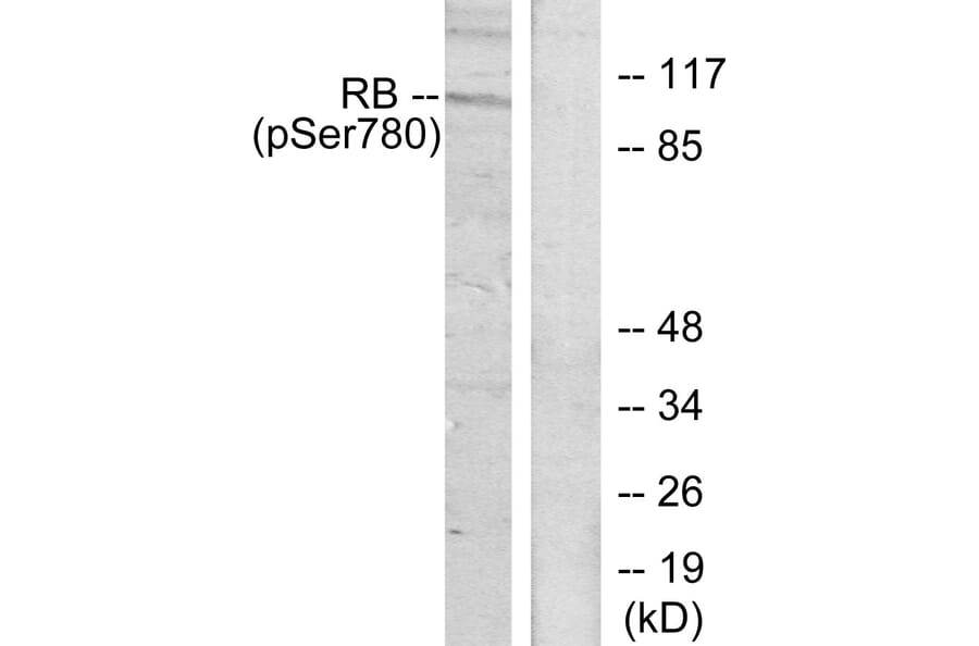 Western Blot - Anti-Retinoblastoma (phospho Ser780) Antibody (A7208) - Antibodies.com