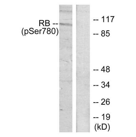 Western Blot - Anti-Retinoblastoma (phospho Ser780) Antibody (A7208) - Antibodies.com