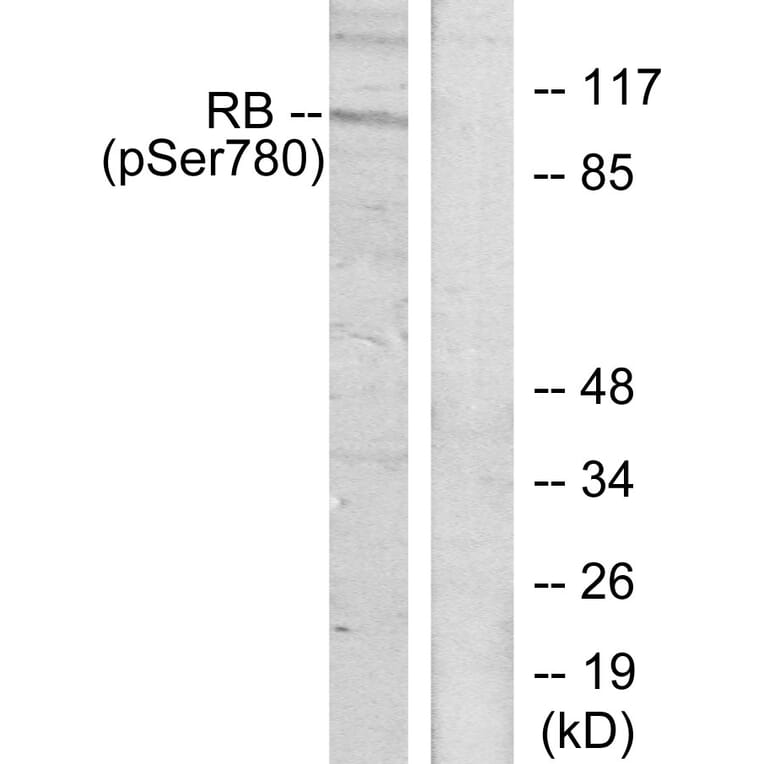 Western Blot - Anti-Retinoblastoma (phospho Ser780) Antibody (A7208) - Antibodies.com