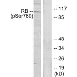 Western Blot - Anti-Retinoblastoma (phospho Ser780) Antibody (A7208) - Antibodies.com