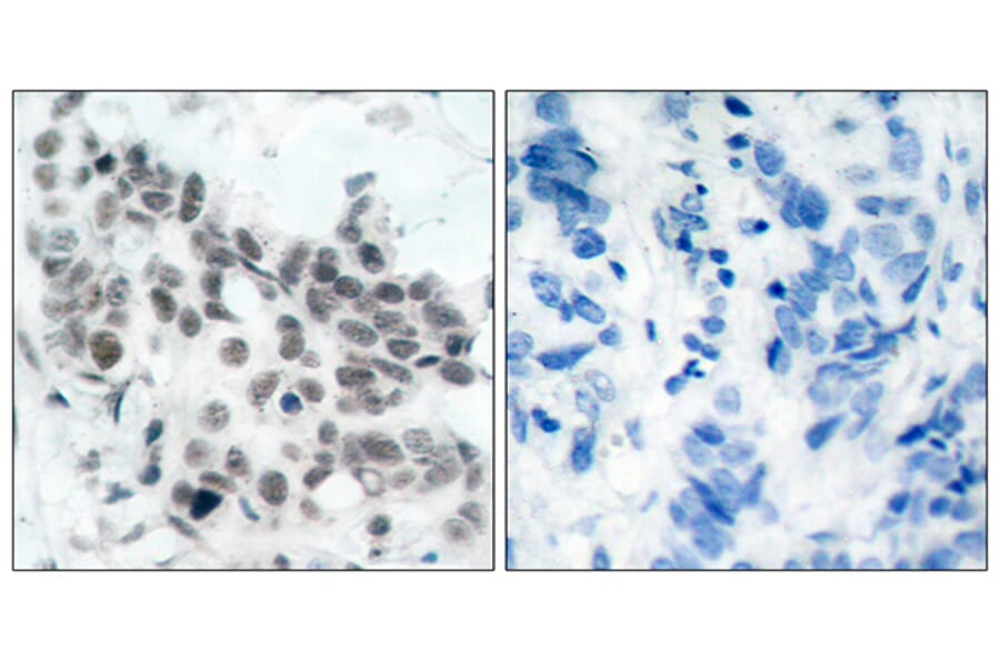 Immunohistochemistry - Anti-Retinoblastoma (phospho Ser780) Antibody (A7208) - Antibodies.com