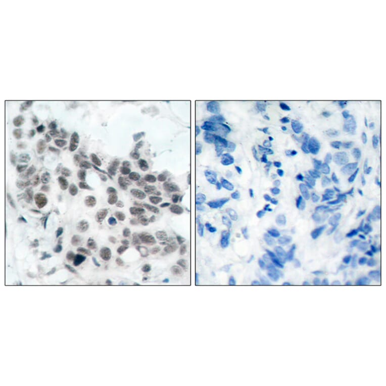 Immunohistochemistry - Anti-Retinoblastoma (phospho Ser780) Antibody (A7208) - Antibodies.com