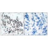 Immunohistochemistry - Anti-Retinoblastoma (phospho Ser780) Antibody (A7208) - Antibodies.com