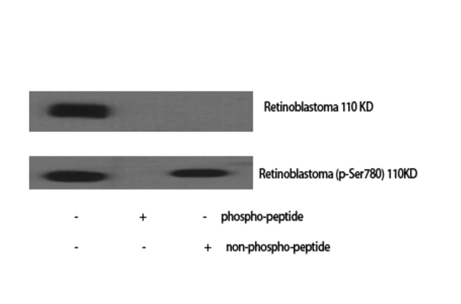 Western Blot - Anti-Retinoblastoma (phospho Ser780) Antibody (A7208) - Antibodies.com