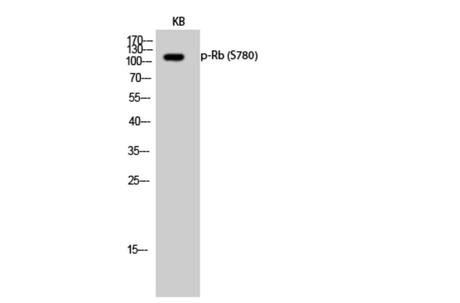 Western Blot - Anti-Retinoblastoma (phospho Ser780) Antibody (A7208) - Antibodies.com