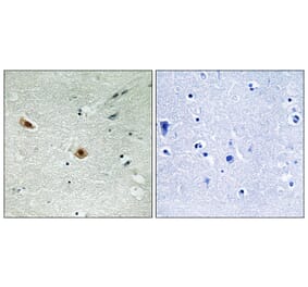 Immunohistochemistry - Anti-Retinoblastoma (phospho Ser608) Antibody (A8059) - Antibodies.com