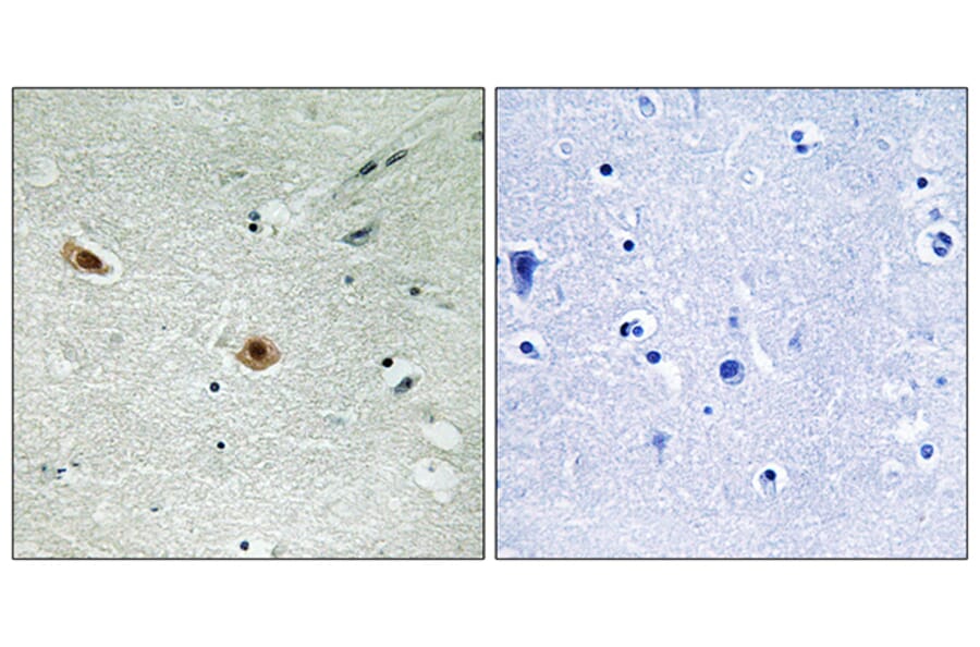 Immunohistochemistry - Anti-Retinoblastoma (phospho Ser608) Antibody (A8059) - Antibodies.com