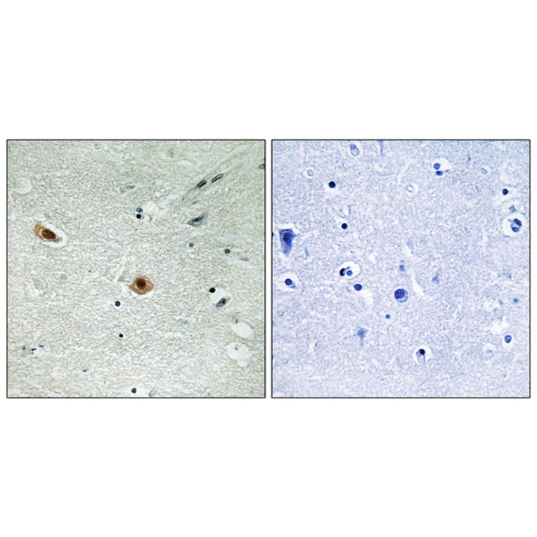 Immunohistochemistry - Anti-Retinoblastoma (phospho Ser608) Antibody (A8059) - Antibodies.com