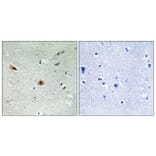 Immunohistochemistry - Anti-Retinoblastoma (phospho Ser608) Antibody (A8059) - Antibodies.com