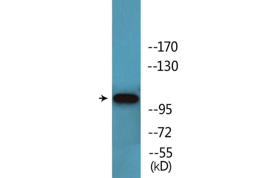 Western Blot - Anti-Retinoblastoma (phospho Ser608) Antibody (P12-1169) - Antibodies.com