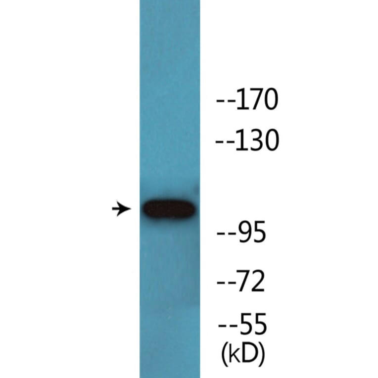 Western Blot - Anti-Retinoblastoma (phospho Ser608) Antibody (P12-1169) - Antibodies.com