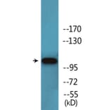 Western Blot - Anti-Retinoblastoma (phospho Ser608) Antibody (P12-1169) - Antibodies.com