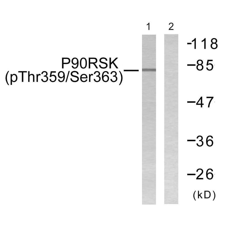 Western Blot - Anti-p90 RSK (phospho Thr359+Ser363) Antibody (A0535) - Antibodies.com