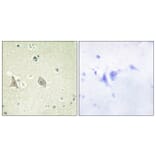Immunohistochemistry - Anti-M-CSF Receptor (phospho Tyr723) Antibody (A0679) - Antibodies.com