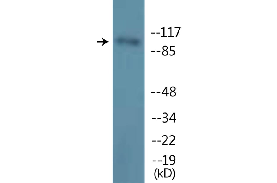Western Blot - Anti-M-CSF Receptor (phospho Tyr723) Antibody (P12-1146) - Antibodies.com