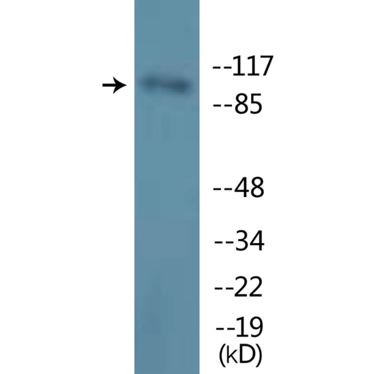 Western Blot - Anti-M-CSF Receptor (phospho Tyr723) Antibody (P12-1146) - Antibodies.com