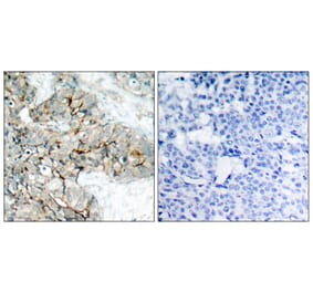 Immunohistochemistry - Anti-Integrin beta3 (phospho Tyr773) Antibody (A7118) - Antibodies.com