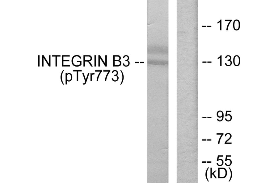 Western Blot - Anti-Integrin beta3 (phospho Tyr773) Antibody (A7118) - Antibodies.com